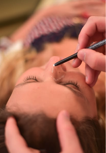 Rinoplastia